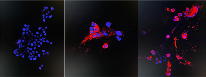 Immunofluorescence staining of uninfected and infected Vero E6 cells
left: Uninfected sample (the negative control)
middle: 24 hours post infection
right: 48 hours post infection (see red fluorescent cytoplasmic antigen staining under confocal microscopy)
Photo credit: Department of Microbiology, HKU